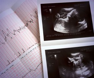 ecocardiografia-fetal-300x250.jpg
