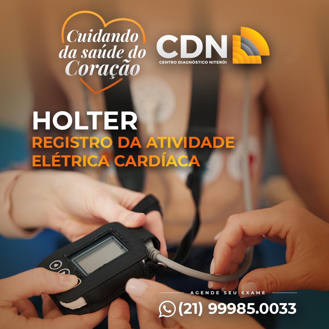 Holter: Registro da atividade elétrica cardíaca