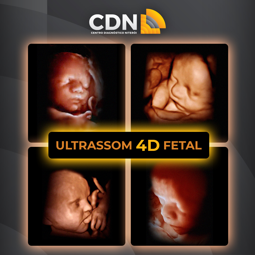 Ultrassom 4D Fetal, agora no CDN!